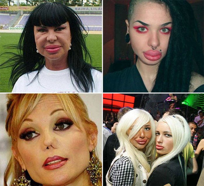 plastic_surgery_fails_19-1