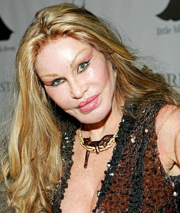 plastic_surgery_fails_20-1