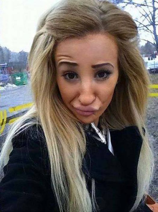 plastic_surgery_fails_22-1