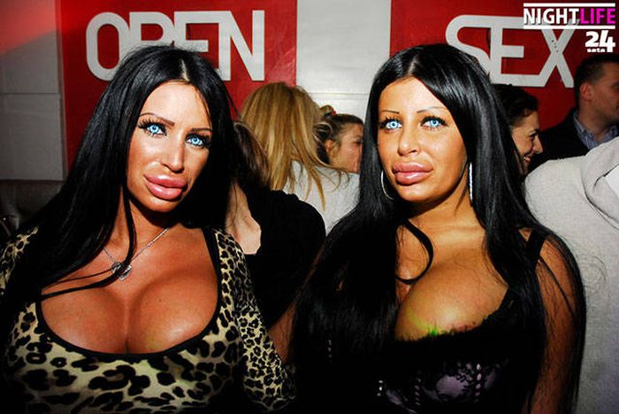 plastic_surgery_fails_23-1