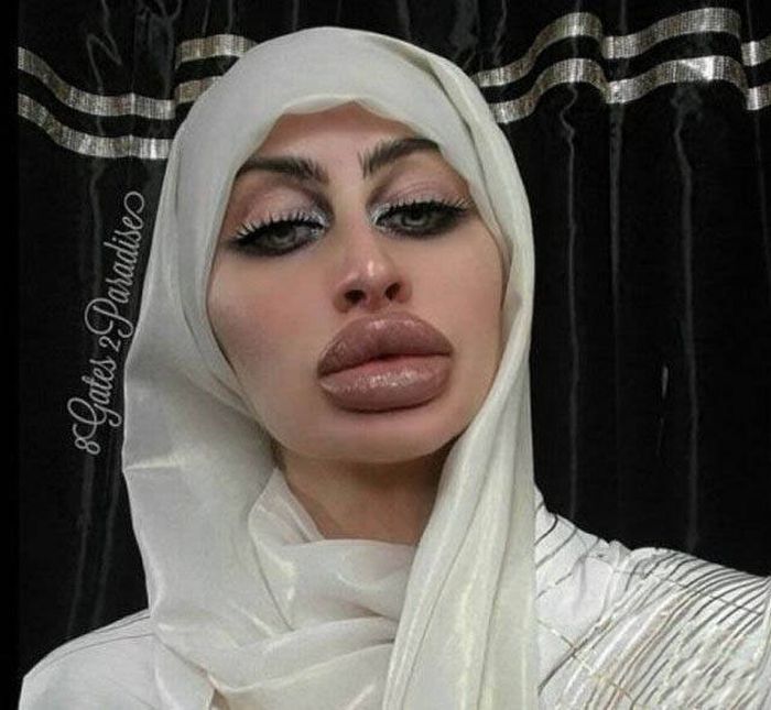 plastic_surgery_fails_36-1