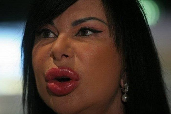 plastic_surgery_fails_37-1