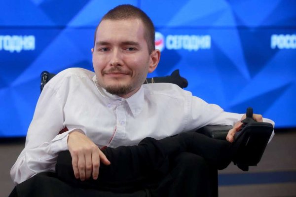 worlds-first-human-head-transplant-to-take-place-in-8-months-21
